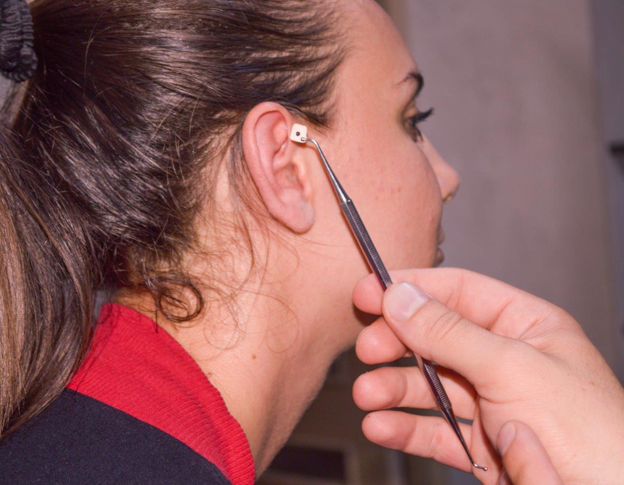 product Аурикулотерапия image carousel