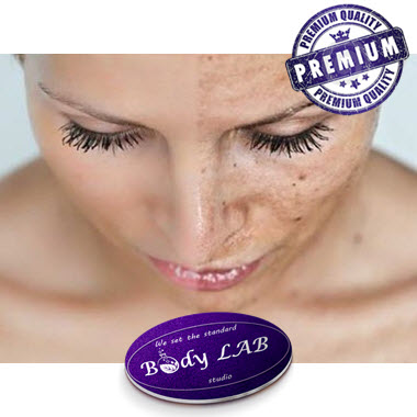 product Лазерно премахване на пигментни петна image carousel